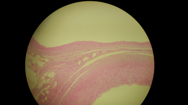 Artery and Vein Slides - Artery and Vein 005 100X